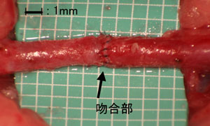 写真2　マイクロサージャリーを用いて吻合した直径 約１mmの血管