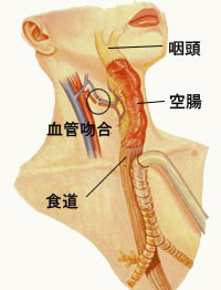 図5　空腸移植による頚部食道再建の シェーマ